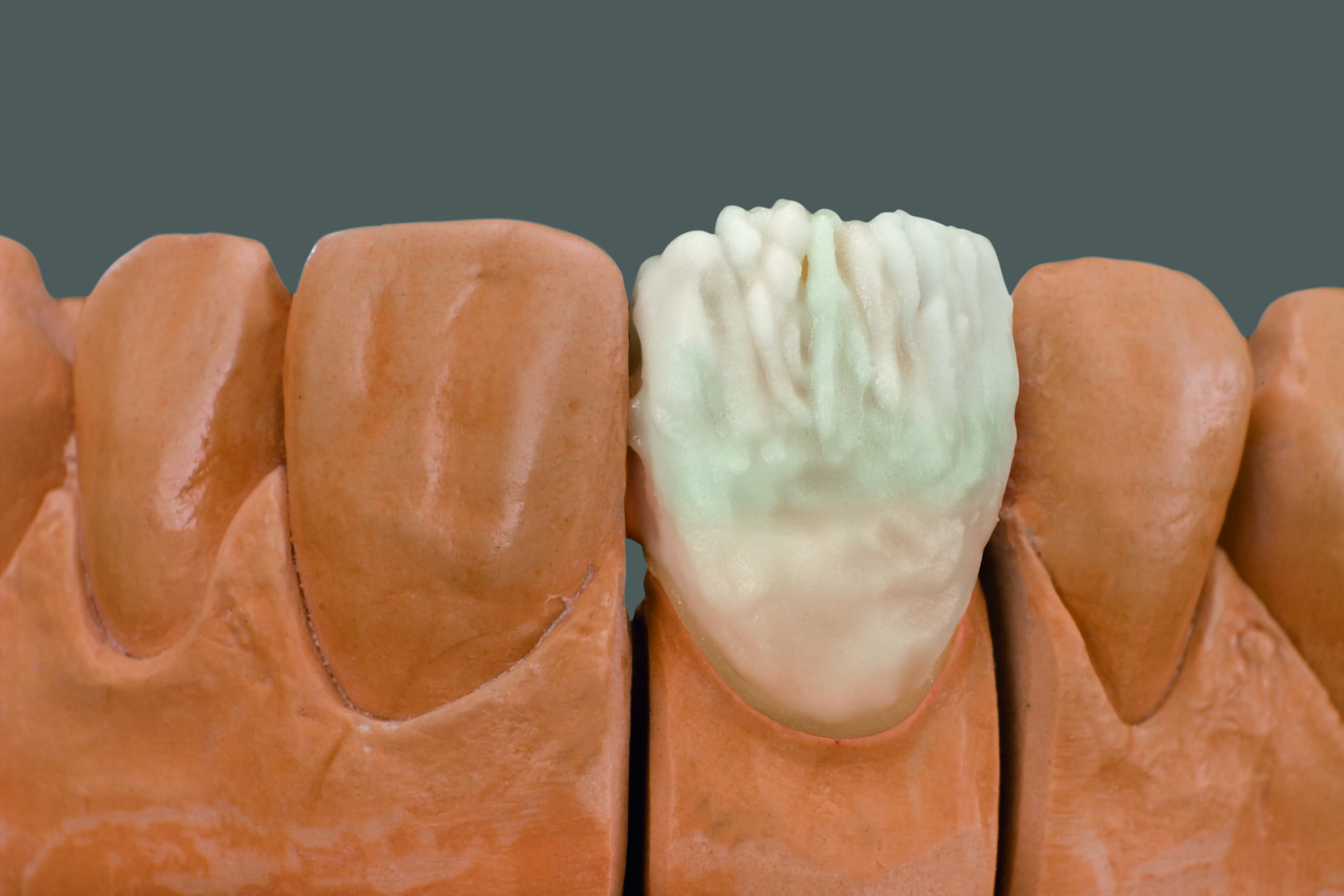 eoma-ceramic-evolution-2026-3_1