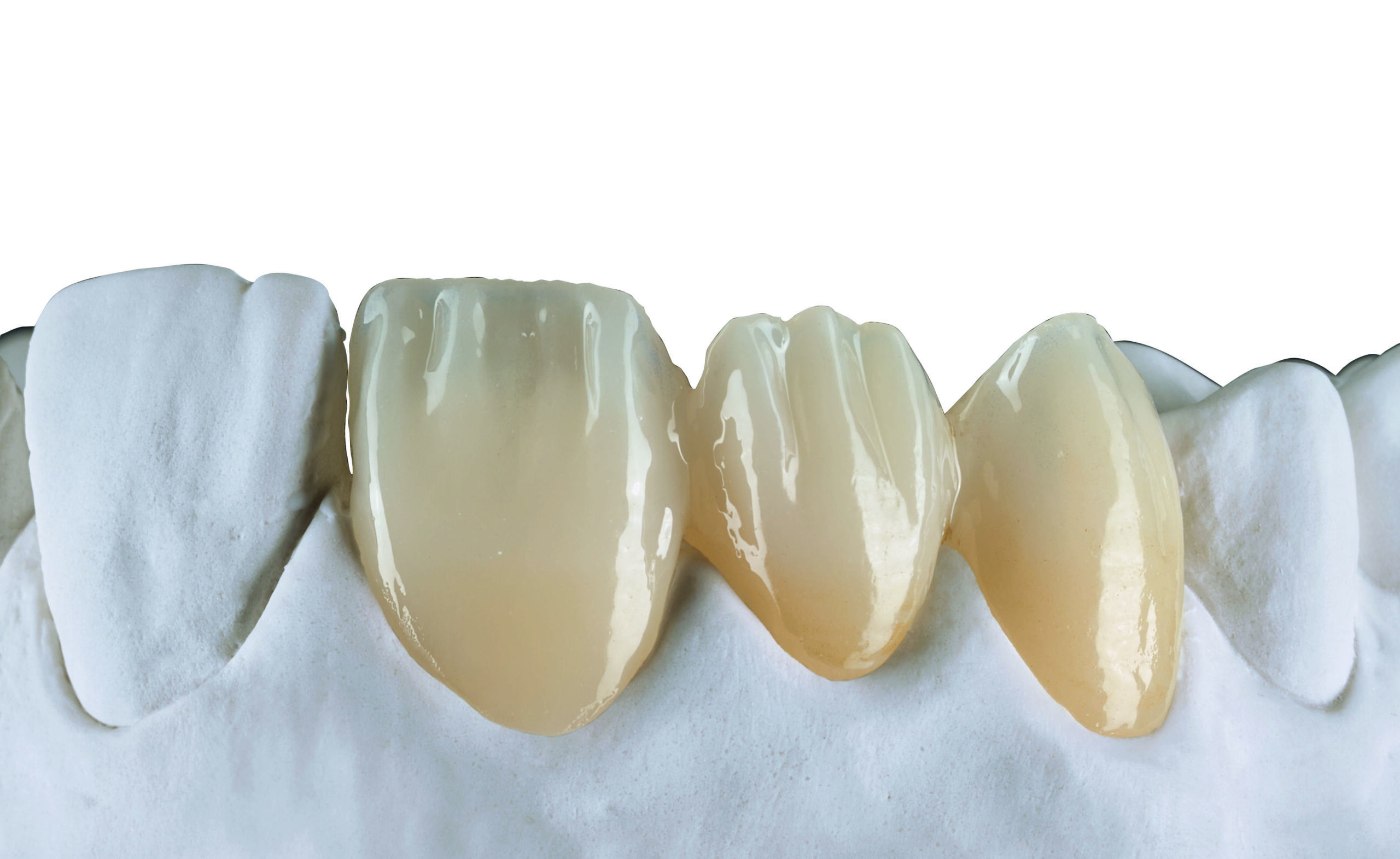 eoma-ceramic-evolution-2026-7