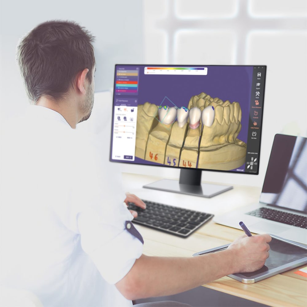 exocad-chairsidecad-software-cad-cam