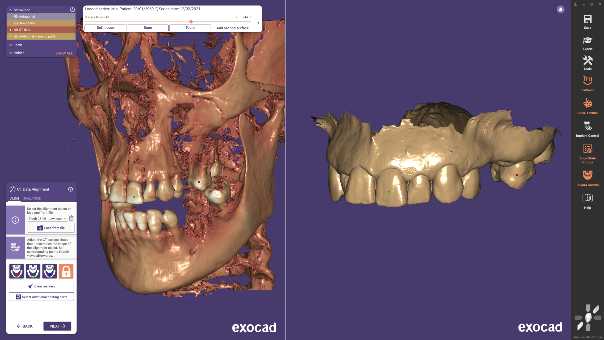 imgi_14_03_-_Align_your_CBCT